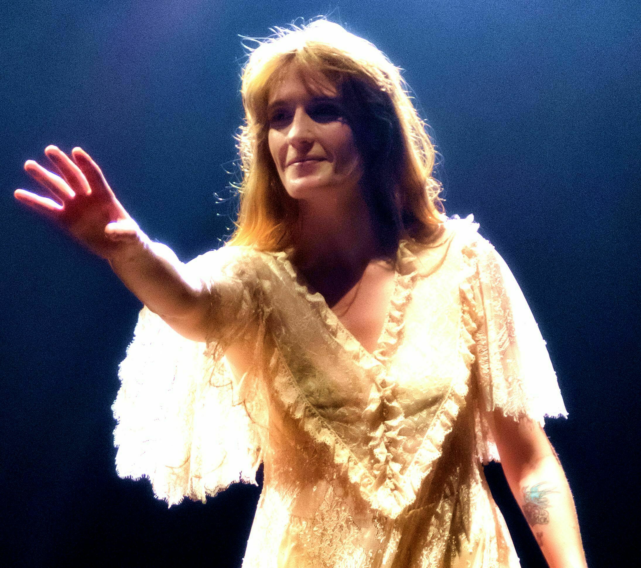 Florence Welch surgery